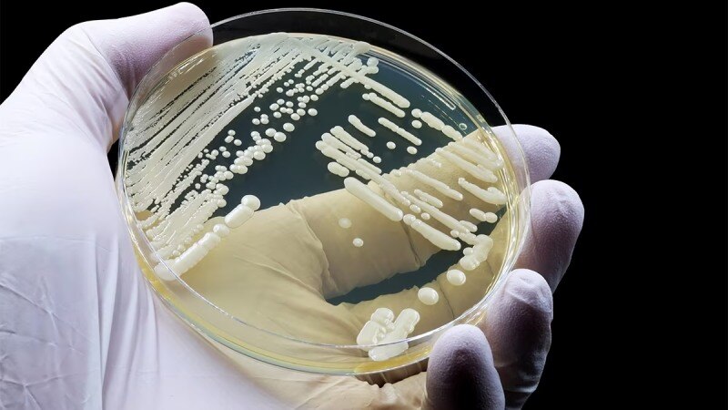 Távoli UV-C vs. Candida auris: új korszak a fertőzéskontroll terén